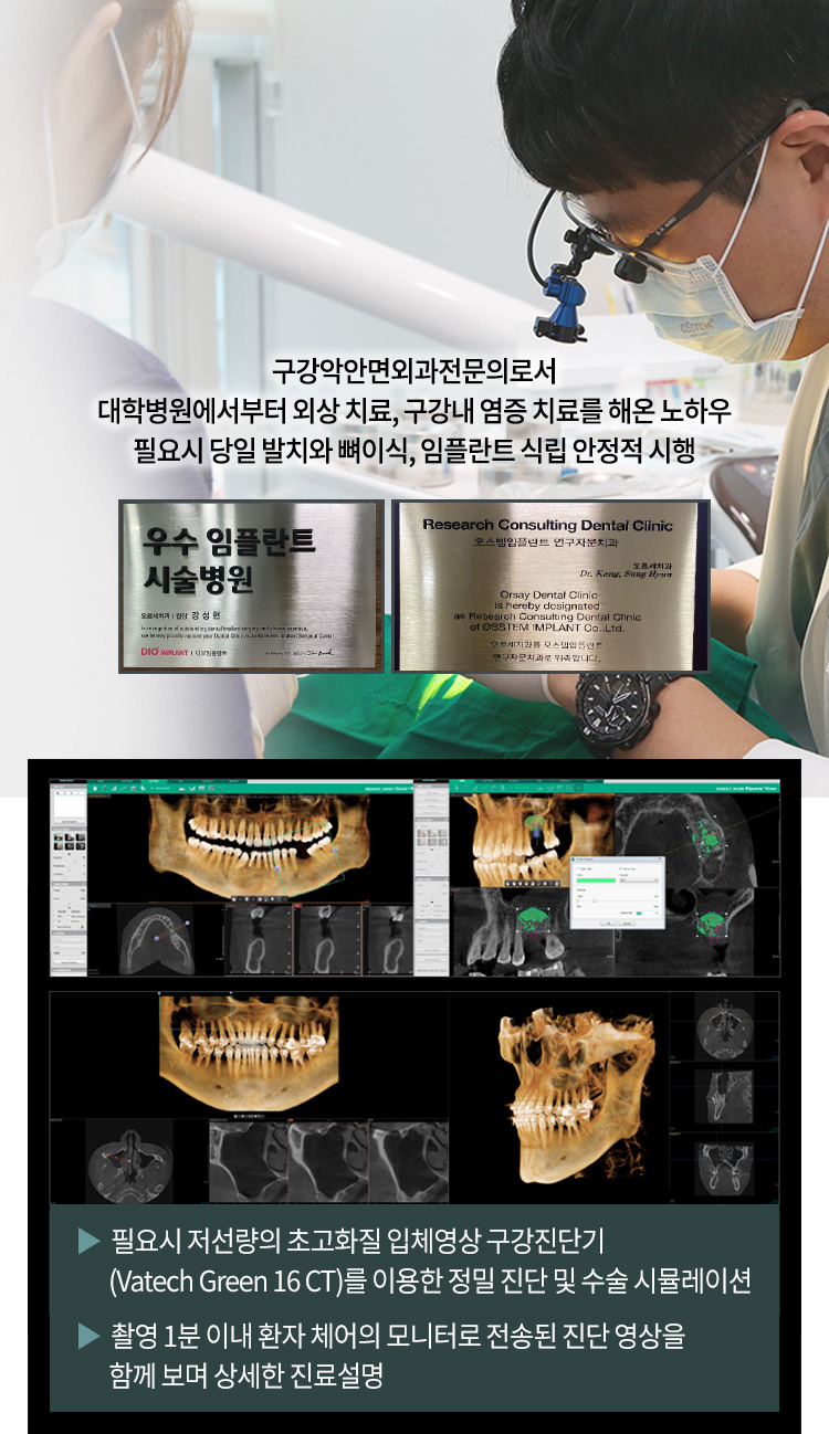 ▶ 필요시 저선량의 초고화질 입체영상 구강진단기(Vatech Green 16 CT)를 이용한 정밀 진단 및 수술 시뮬레이션 / ▶ 촬영 1분 이내 환자 체어의 모니터로 전송된 진단 영상을 함께 보며 상세한 진료설명